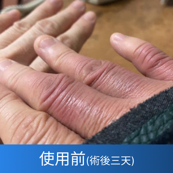 使用前